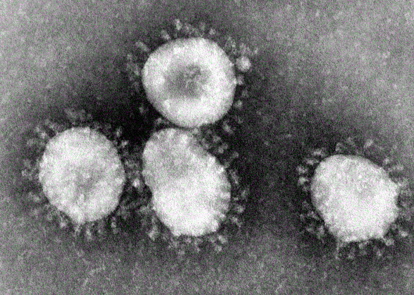 Electron microscopic Corona virus
